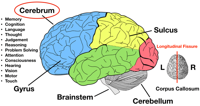 Match the label to its appropriate region of the brainstem