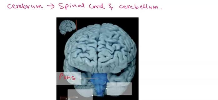 Brain spinal cord diencephalon cancer human