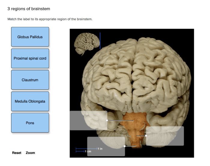 Match the label to its appropriate region of the brainstem