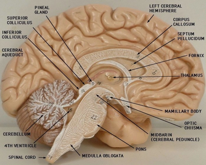 Drag the labels to identify the ventricles of the brain.